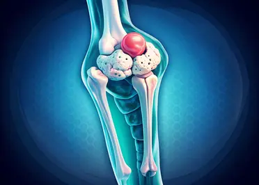 bone-and-soft-tissue-tumors